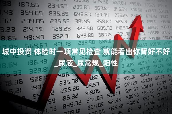城中投资 体检时一项常见检查 就能看出你肾好不好_尿液_尿常规_阳性